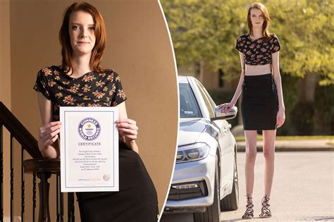 teen mega world pics|Teen with 'longest legs in the world' now has an OnlyFans.